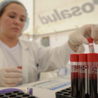 Científicos estudian ganglios linfáticos para vacuna contra VIH