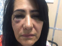 Según denuncias, la pasajera fue violada, asaltada y golpeada cuando viajaba en un autobús de la empresa ETN. FACEBOOK / Adolfo Micalco Mendez