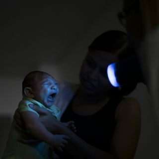 Confirman en Florida el primer caso de microcefalia por zika