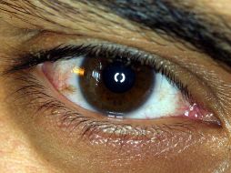 Los síntomas de ojo seco son irritación, lagrimeo, sensación de arena en el ojo y disminución de la visión. EL INFORMADOR / ARCHIVO