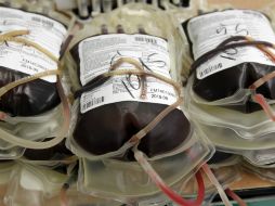 En México existen registrados cinco mil 221 pacientes con hemofilia. SUN / ARCHIVO