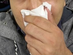 La congestión y escurrimiento de la nariz y el lagrimeo son sólo algunos síntomas de las alergias. EL INFORMADOR /