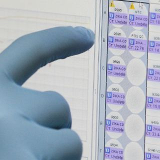 La SSa descarta casos de microcefalia por zika