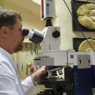 Enfermedades neurológicas repercuten en problemas de visión