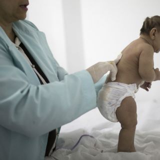 Texas registra primera muerte relacionada con el zika