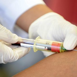 Hallan mutación que bloquea entrada del VIH en organismo