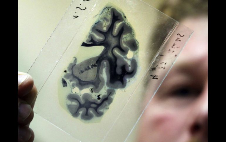 Las pruebas demostraron que el córtex cingulado anterior subgenual se activa cuando se ayuda a los demás. EFE / ARCHIVO