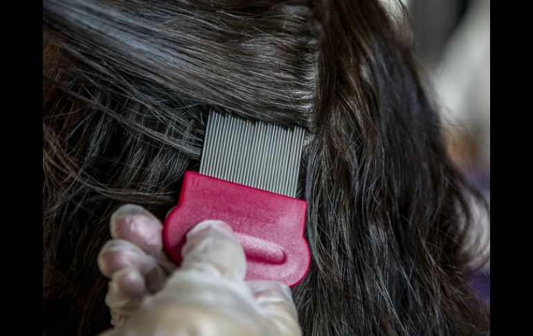 Científicos holandeses recuerdan que uno de cada diez adultos tiene piojos en su cabeza. EL INFORMADOR / ARCHIVO