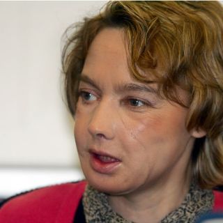 Muere primera paciente de trasplante de rostro