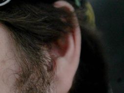 Una infección dentro del oído puede resultar en la formación de un tumor anormal llamado 'cholesteatoma'. EL INFORMADOR / ARCHIVO