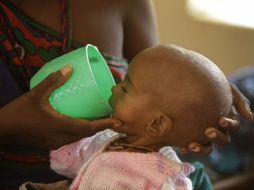 Para superar esa situación, los menores necesitan ser nutridos en primera instancia con alimentos terapéuticos. AP / ARCHIVO