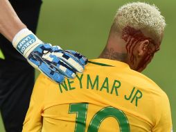 Neymar dio un susto al sangró tras un choque fortuito y fue preservado por Tite al dejar su puesto a los 68 minutos. AFP / N. Almeida