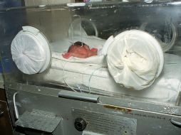 Los bebés prematuros tienen un alto riesgo de requerir hospitalización, incluso cuidados intensivos y ventilación mecánica. EL INFORMADOR / ARCHIVO