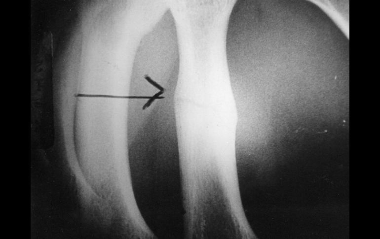 El consumo de vitamina D es fundamental para fijar el calcio a los huesos. EL INFORMADOR / ARCHIVO