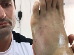 Horas antes del partido ante Cruz Azul, el jugador aún no estaba seguro de poder participar en el encuentro. TWITTER / @lideresrebano