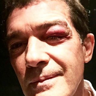 Antonio Banderas sufre pequeño accidente en filmación