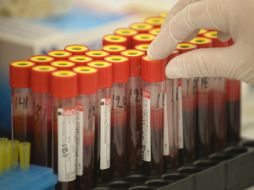 A través de una muestra sanguínea se puede confirmar si se trata de talasemias o anemias de origen genético. EFE / ARCHIVO