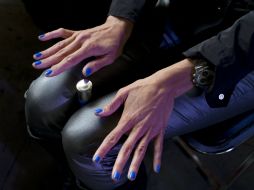 Una uña saludable debería ser de color rosado, con un toque más blanquecino cerca de la base. AP / ARCHIVO