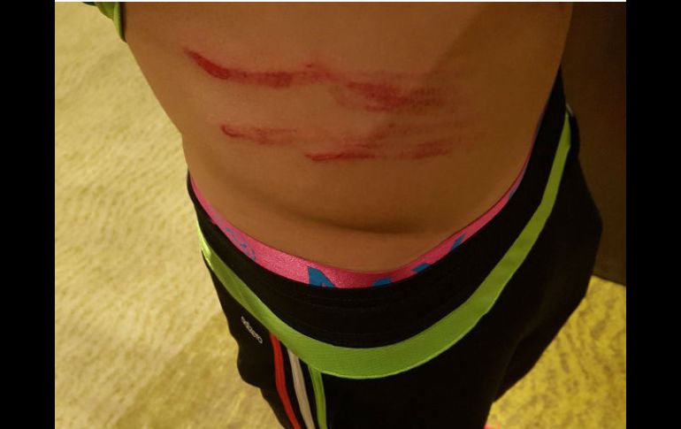 El delantero se llevó un golpe disputando un balón por aire. TWITTER / @Raul_Jimenez9