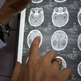 Declaran zona de Miami Beach libre de virus del Zika