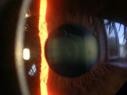 Al ser la córnea una superficie de reflexión especular se puede evaluar como si fuera un espejo convexo. ESPECIAL / Wikicommons