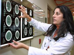 Se busca una respuesta biológica a cómo tiene lugar en el cerebro la estimación variable del tiempo. AP / ARCHIVO