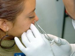 Las mujeres de entre 16 y 35 años son las que más recurren a este procedimiento cosmético. EL INFORMADOR / ARCHIVO