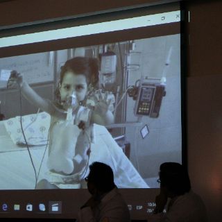 Médicos trasplantan con éxito corazón artificial