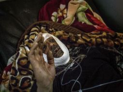 Un hombre lesionado en el ataque pide ayuda en un hospital en la ciudad de Irbil. AP / M. Brabo