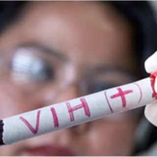 Identifican nuevos factores celulares vinculados con VIH