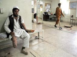 Ante la falta de personal médico y medicamentos, la amputación de un miembro es la única práctica en las pocas clínicas de Alepo. AFP / ARCHIVO