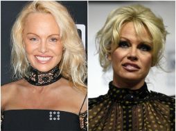 Señalan que Pamela Anderson no lucía ninguna línea de expresión, por lo que surgieron rumores de una intervención estética. ESPECIAL /
