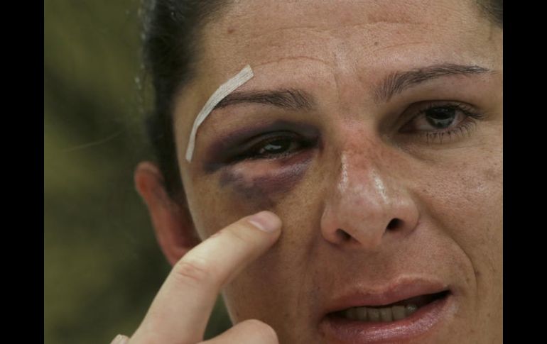 El presunto agresor por las lesiones de Ana Guevara recibió una fianza de 46 mil pesos por parte del juez. AP / ARCHIVO