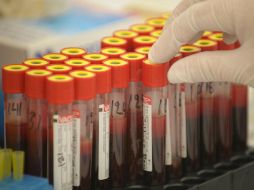 El estudio está basado en la detección de un marcador específico -la proteína EphA2- en algunas vesículas extracelulares. EFE / ARCHIVO