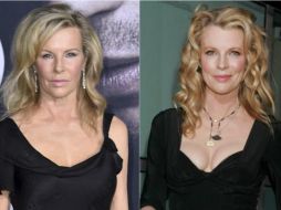 Las críticas fueron sobre intervenciones estéticas a las que posiblemente se sometió. ESPECIAL / AP y Archivo