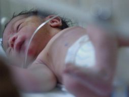 Los nacimientos antes de término han aumentado drásticamente en las últimas dos décadas. EL INFORMADOR / ARCHIVO