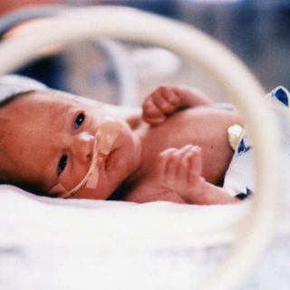 Crecimiento rápido del cerebro en bebés, síntoma de autismo