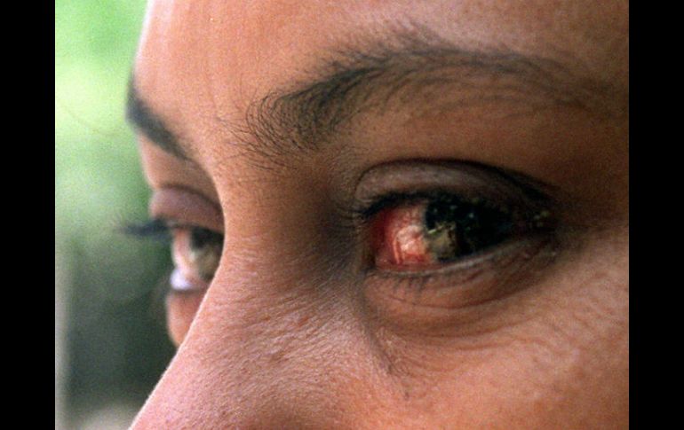 La falta de lubricación ocular puede generar conjuntivitis alérgica o infecciosa, así como alteraciones a nivel de la córnea. EL INFORMADOR / ARCHIVO