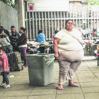 Analizan incluir cirugía bariátrica en Seguro Popular