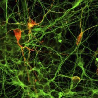Mal de Huntington altera neuronas desde que inician su desarrollo