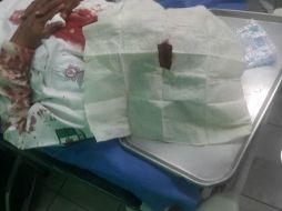 El oficial vial fue agredido ayer martes en el cruce de avenida Colón y Periférico por un hombre y una mujer. ESPECIAL /