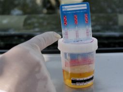 Todos fueron todos descalificados debido a la presencia en sus muestras de un esteroide anabolizante, el turinabol. EL INFORMADOR / ARCHIVO