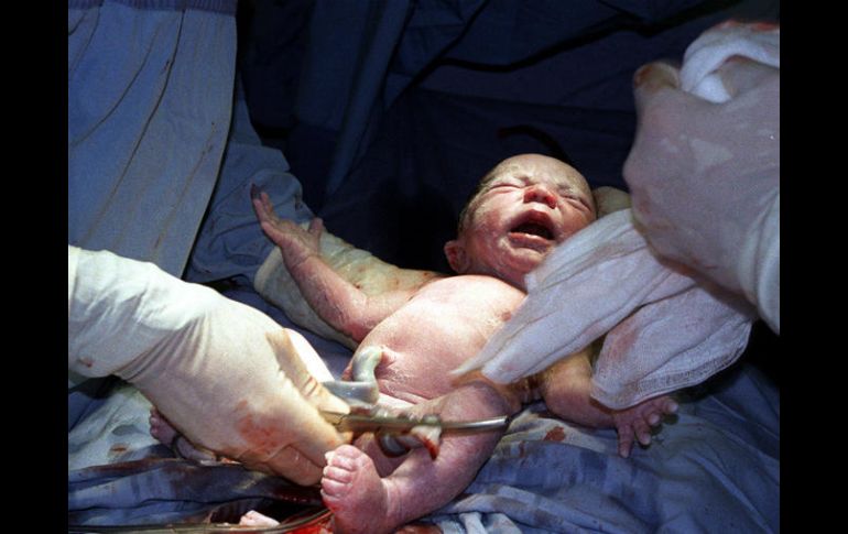 La incidencia del padecimiento alcanza un caso por cada 18 mil recién nacidos. EL INFORMADOR / ARCHIVO