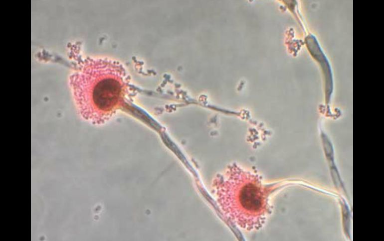Diferentes microorganismos pueden permear hasta el cerebro y ocasionar síntomas que pueden comprometer la vida del paciente. AFP / ARCHIVO