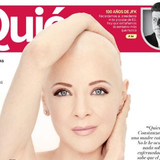 Edith González se muestra sin cabello en portada de 'Quién'