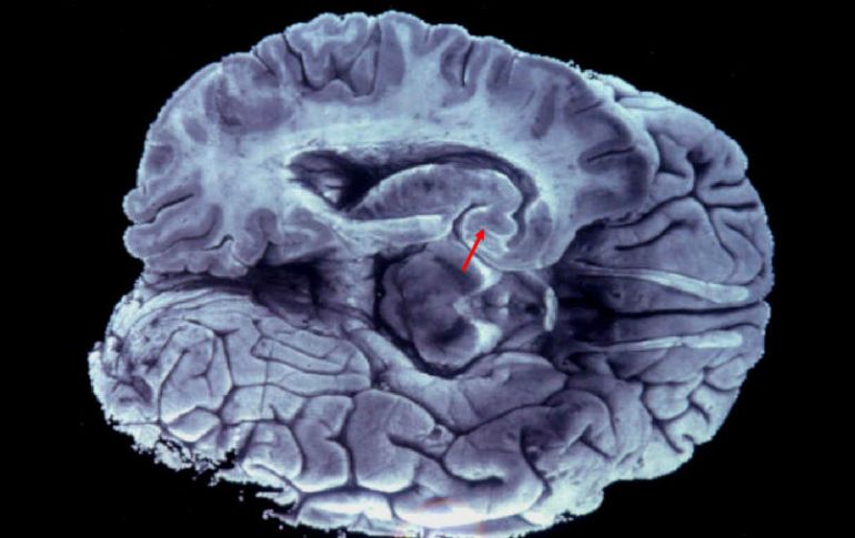 El órgano está dividido en dos hemisferios y para actuar en común se conectan mediante fibras nerviosas. EFE / ARCHIVO