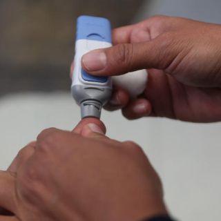 Diabéticos, con mayor posibilidad de padecer tuberculosis