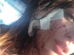 Zambrano publicó en Facebook videos en los que daba cuenta de la agresión por parte de una empleada de un antro en Cancún. TWITTER / @brenzambranoc