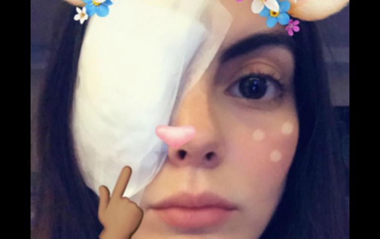 Ximena Navarrete tuvo problemas con ojo y se sometió a cirugía. INSTAGRAM / ximenanr