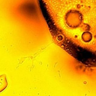 Probióticos, bacterias buenas que mantienen la salud intestinal